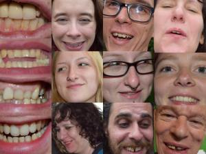 amm teeth